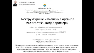 УЗИ органов малого таза у женщин: обзор видеопримеров