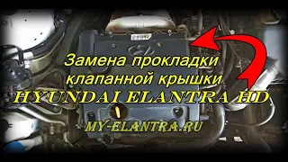 Замена прокладки клапанной крышки Hyundai Elantra HD!