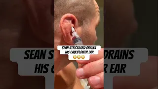 😳💉SEAN STRICKLAND DRAINS HIS CAULIFLOWER EAR