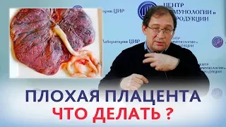 ПЛОХАЯ ПЛАЦЕНТА. ЧТО ДЕЛАТЬ если врач сказал, что была плохая плацента? Отвечает доктор Гузов.