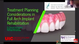 Treatment Planning in Full Arch Implant Rehabilitation - Dr Shouvik Ponnusamy