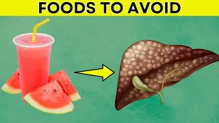 IMMEDIATELY Avoid These 8 Types Of Foods If You Have A Fatty Liver | Daily Joy
