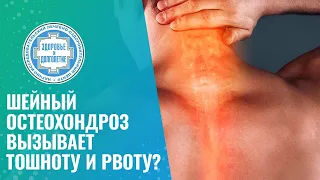 🤔 Шейный остеохондроз вызывает тошноту и рвоту?