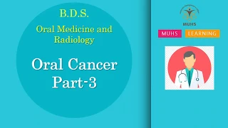 Oral Cancer Part-3 | Oral Medicine and Radiology | BDS | 00848 | PPT Only