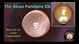 Review of the Alcon PanOptix lens for Cataract Surgery