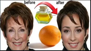 Face lift with natural collagen! At the age of seventy, wrinkles disappear