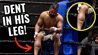 Kicks Leave a DENT in Fighter’s Leg! Doctor Explains Strange MMA Moment