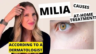 Dermatologist Explains Milia: Causes, At-Home Skincare Treatments, & Prevention | Dr. Sam Ellis