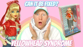 Yellowhead Sticky Syndrome: Can it be fixed? 🎀🧼💛 Doll restoration