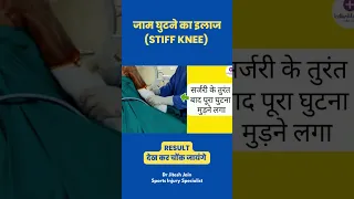 जाम घुटने को तुरंत सीधा कर दिया | Stiff Knee Treatment - Dr Jitesh #shorts #kneesurgey #kneepain