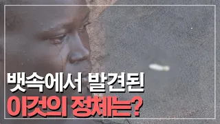 한 여성의 뱃속에서 발견된 '이것'의 정체는?