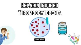 🩺 Understanding Heparin-Induced Thrombocytopenia (HIT): Causes, pathophysiology, and Treatment 🩺