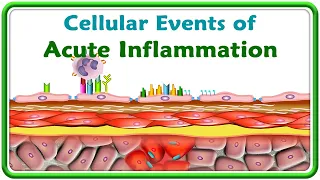 3. Cellular events of Acute Inflammation ( Animation )