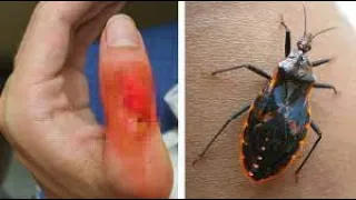 5 Most Dangerous Bugs You Should Run Away From Part 1- Top 10 Facts