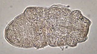 Different Tardigrades / Waterbears Under a Microscope
