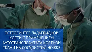 Остеосинтез ладьевидной кости с применением аутотрансплантата костной ткани на сосудистой ножке