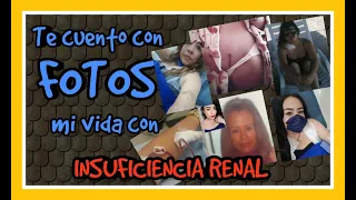 Testimonio  de vida con INSUFICIENCIA RENAL 😟😳/ HEMODIALISIS (fotos)/ Alejandra irc