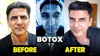 எப்படி இருந்த நான் இப்படி ஆகிட்டேன் 🫢| Full Face Botox Treatment | King Prithiveeraj