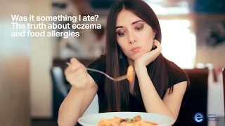 Was it something I ate? The truth about eczema and food allergies