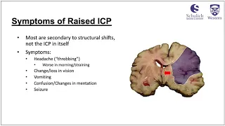Clinical Features of Raised ICP – Acute vs Sub-Acute/Chronic