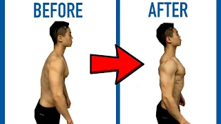 How to FIX YOUR POSTURE in ZERO MINUTES per Day (Fix Rounded Shoulders / Forward Head Posture)