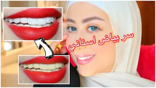 سر بياض اسناني و جمالهم 😍 تجربتي مع الفينيرز ( ابتسامه المشاهير ) 😎 || شهد ناصر 🌸