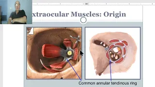 Anatomy of head and neck module in Arabic 38 (Extraocular muscles) , by Dr. Wahdan