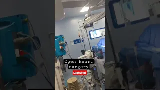 open Heart surgery #shorts #anesthesia #ot #surgery #cardiac #operationtheatre