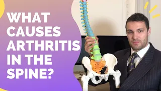 What Causes Arthritis In The Spine?