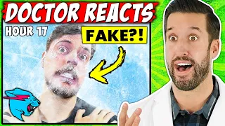 ER Doctor REACTS to MrBeast Most Dangerous Challenges