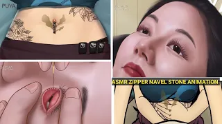 ASMR | ZIPPER NAVEL STONE REMOVAL ANIMATION