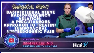 Basivertebral Nerve Radio-frequency Ablation - Jennifer Lee M.D.