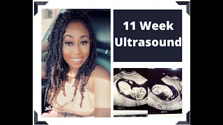 11 Week Twin Ultrasound!