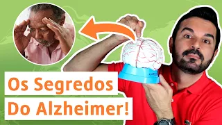 Tudo Sobre Alzheimer! O Que É, Como Aparece, Como Evitar e Como Combater | Dr. Rafael Freitas