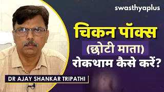 चिकन पॉक्स की रोकथाम कैसे करें? | Symptoms of Chickenpox in Hindi | Dr Ajay Shankar Tripathi