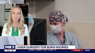 The Burn Center Performs its 1,000th Laser Procedure for Burn Scar Treatment