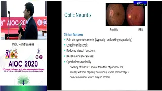 AIOC2020 GP148 T3  Dr Rohit Saxena Approach to Patients with Optic Disc Edema and Pallor