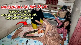 🔴 VIRAL !! DETIK DETIK BAYI BERTUBUH ULAR KELUAR DARI RAHIM WANITA INI