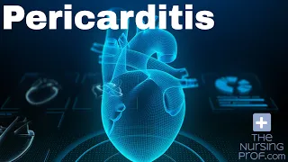 Cardiac Pericarditis