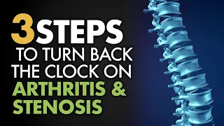 3 Steps to Turn Back the Clock on Arthritis and Stenosis