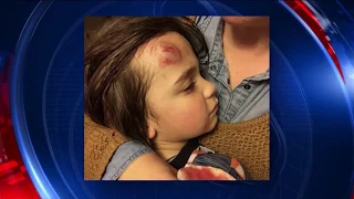 Broken LA sidewalk leads to child getting hurt