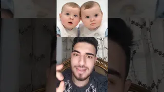 الاطباء حذروهم من الزواج لانهم توائم و عندما تزوجوا !!😱 جزء الثاني