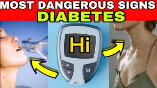 7 MOST DANGEROUS SIGNS of DIABETES that YOU CAN’T IGNORE ‼️