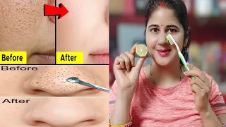 नींबू से सिर्फ 2 uses मैं खत्म करें clogged pores,blackheads,bump,whiteheads and large pores एक साथ