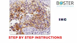 Immunohistochemistry (IHC) | Step by step instructions