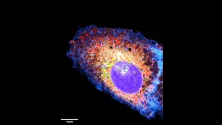 6 organelles imaged simultaneously in a live cancer cell