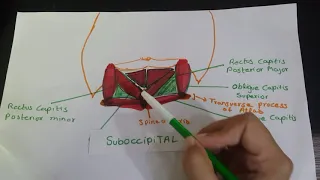 SUBOCCIPITAL  TRIANGLE (Sub occipital Muscles) PART 1