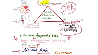 Juvenile  Rheumatoid Arthritis mnemonic