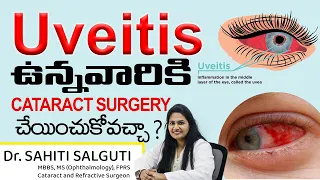 Cataract Surgery in the Patient with Uveitis |  Special Considerations in Cataract Surgery: Uveitis