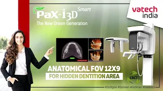 Product Description Vatech CBCT PAX i 3D Smart Dentbear.com